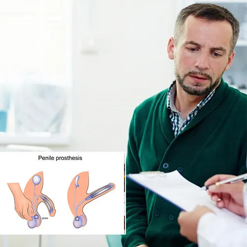 Understanding Your Options: Types of Penile Implants