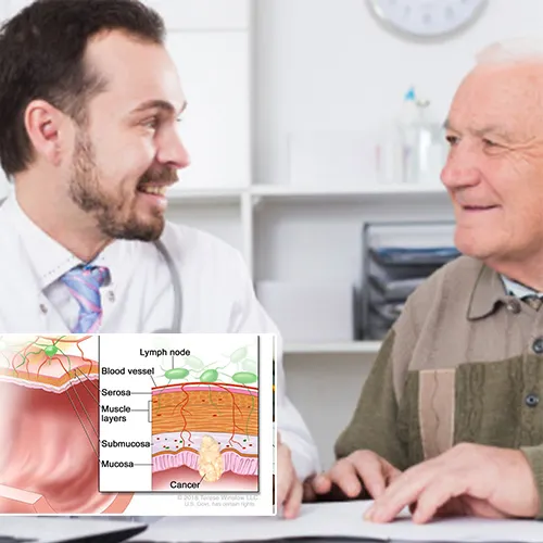 Educating Our Patients:   Advanced Urology Surgery Center 
 



on the Mechanism of VEDs