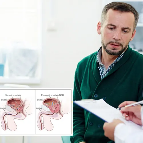Advanced Urology Surgery Center 
 



: Connecting You to a World of Enhanced Intimacy and Confidence
