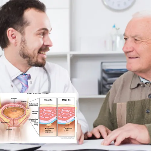 The Consultation Process at   Advanced Urology Surgery Center 
 


