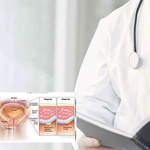 Embark on a Tailored Path with   Advanced Urology Surgery Center 
 



: Navigating the Technicalities